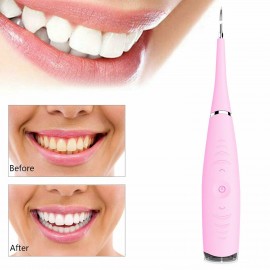 Electric Dental Stain Remover